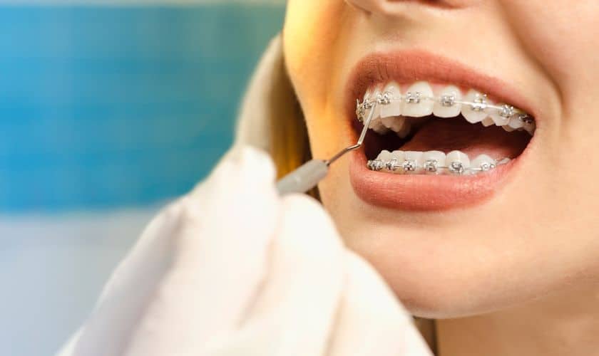 Orthodontist Sugar Land - Avalon Dental Group P.C.