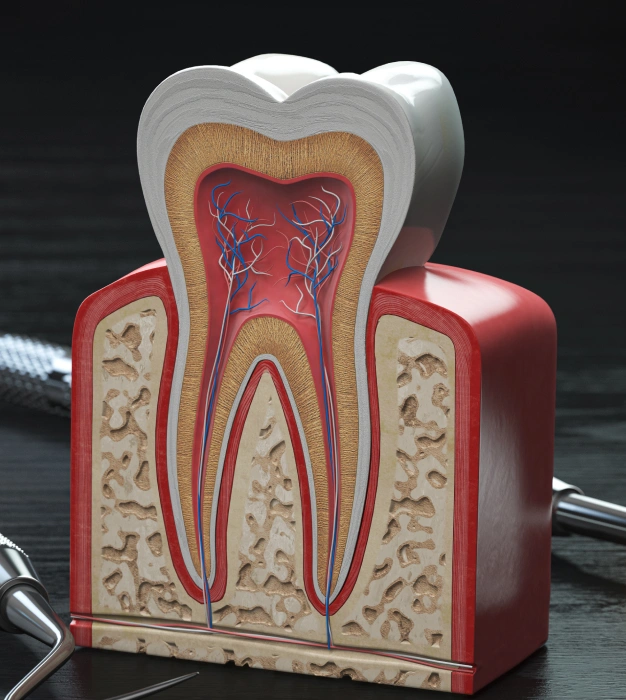 Anatomical dental model showing cross-section of tooth structure with pulp and root canals.