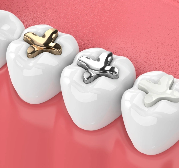 Three white tooth models displaying different dental crown options against a pink background.