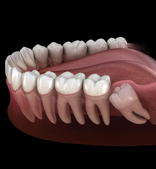 3D dental illustration showing natural teeth arrangement on gum tissue model.