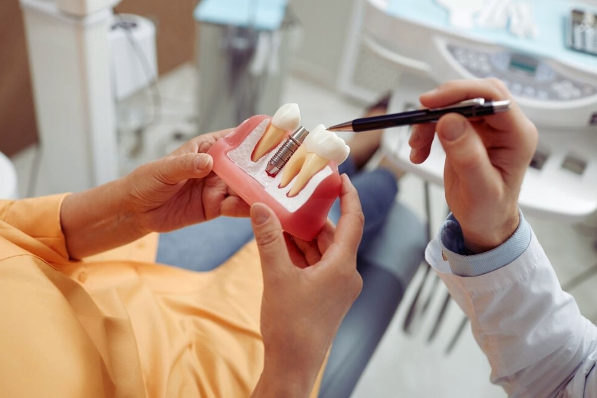 Why dental implants is the Best Long-Term Restoration