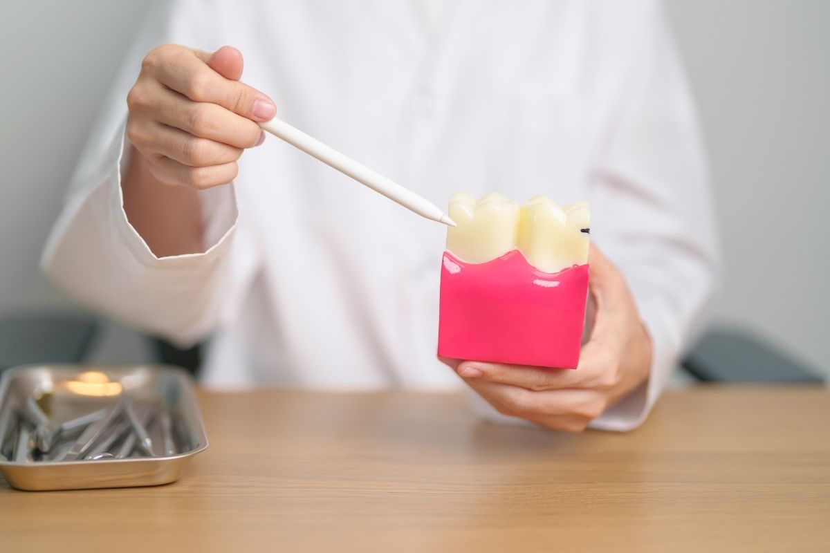 person with model of tooth crowns showing the need for dental crowns after RCT