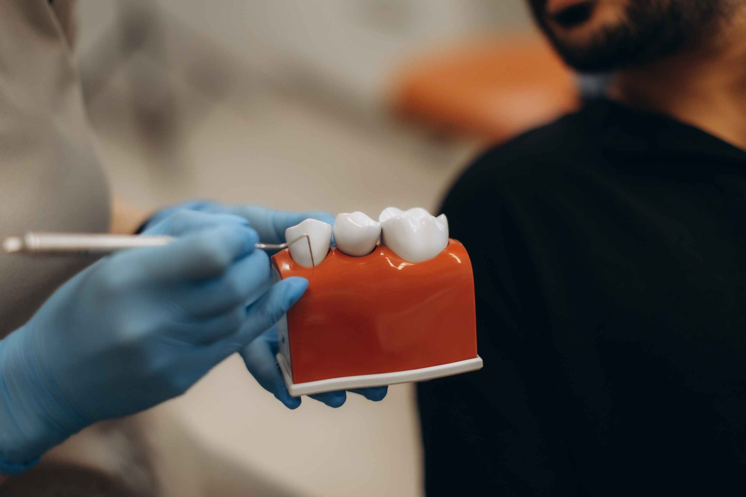 Dentist showing a tooth model to explain the difference between a dental crown and filling for tooth restoration in Katy, TX.